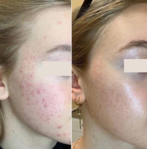 Before and after aesthetic treatment results