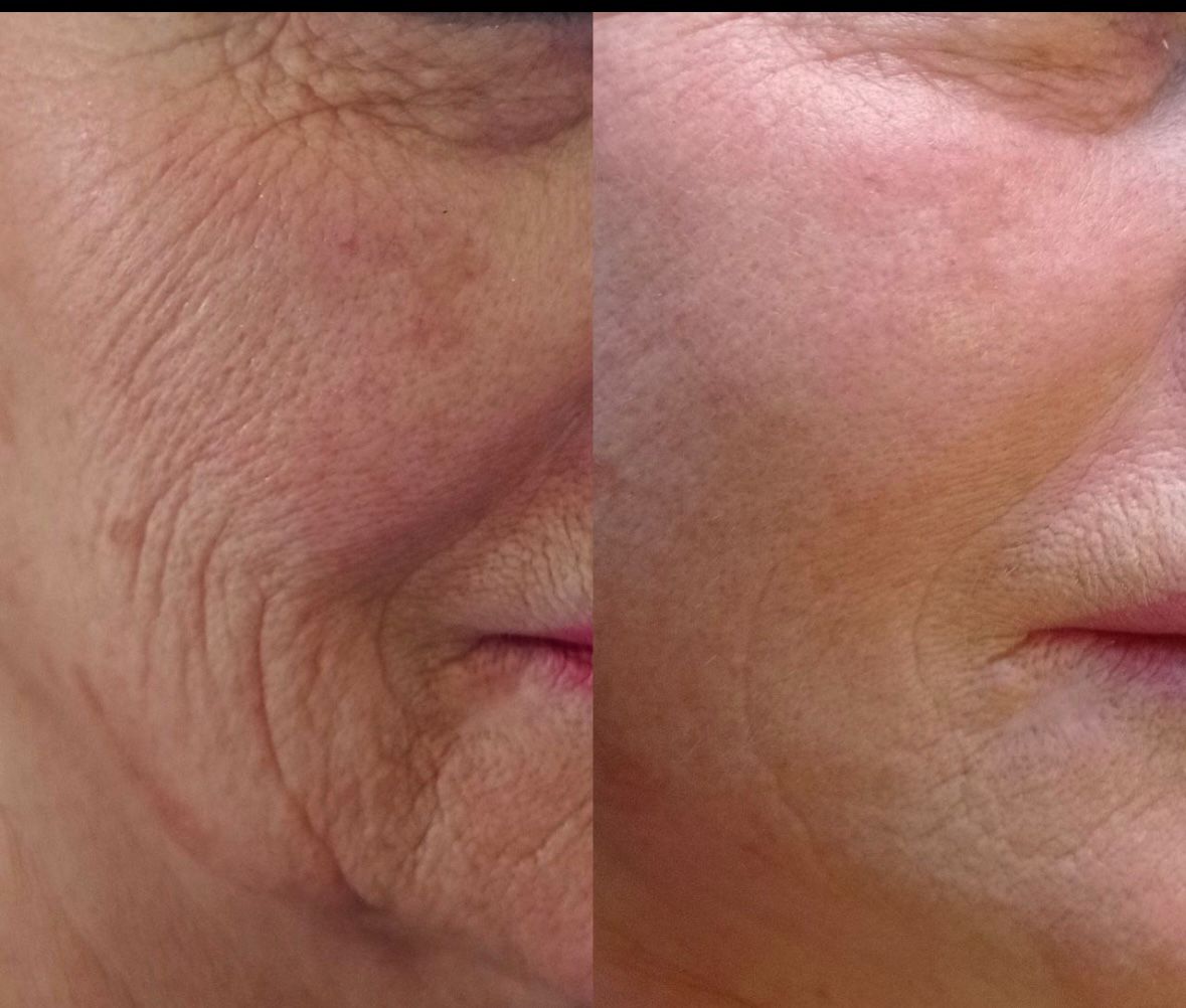 Before and after aesthetic treatment results