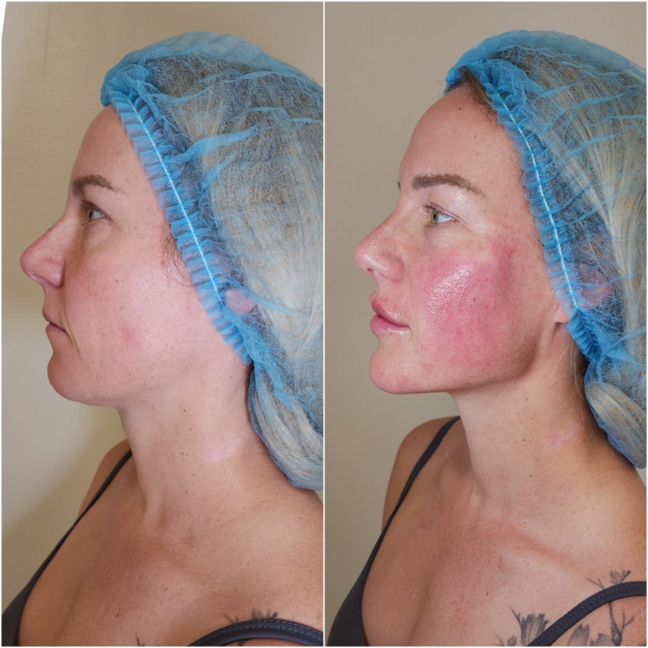 Before and after aesthetic treatment results