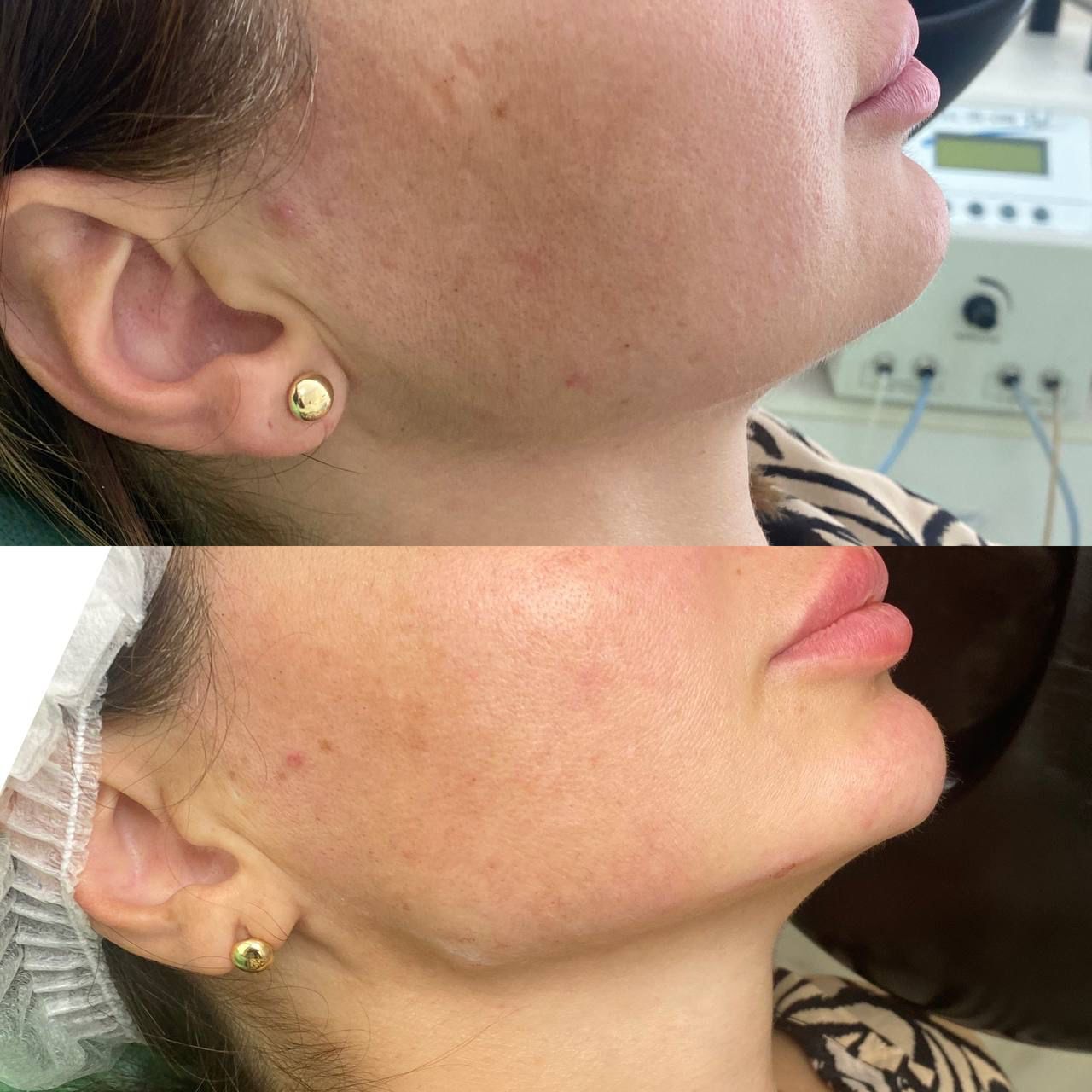 Before and after aesthetic treatment results