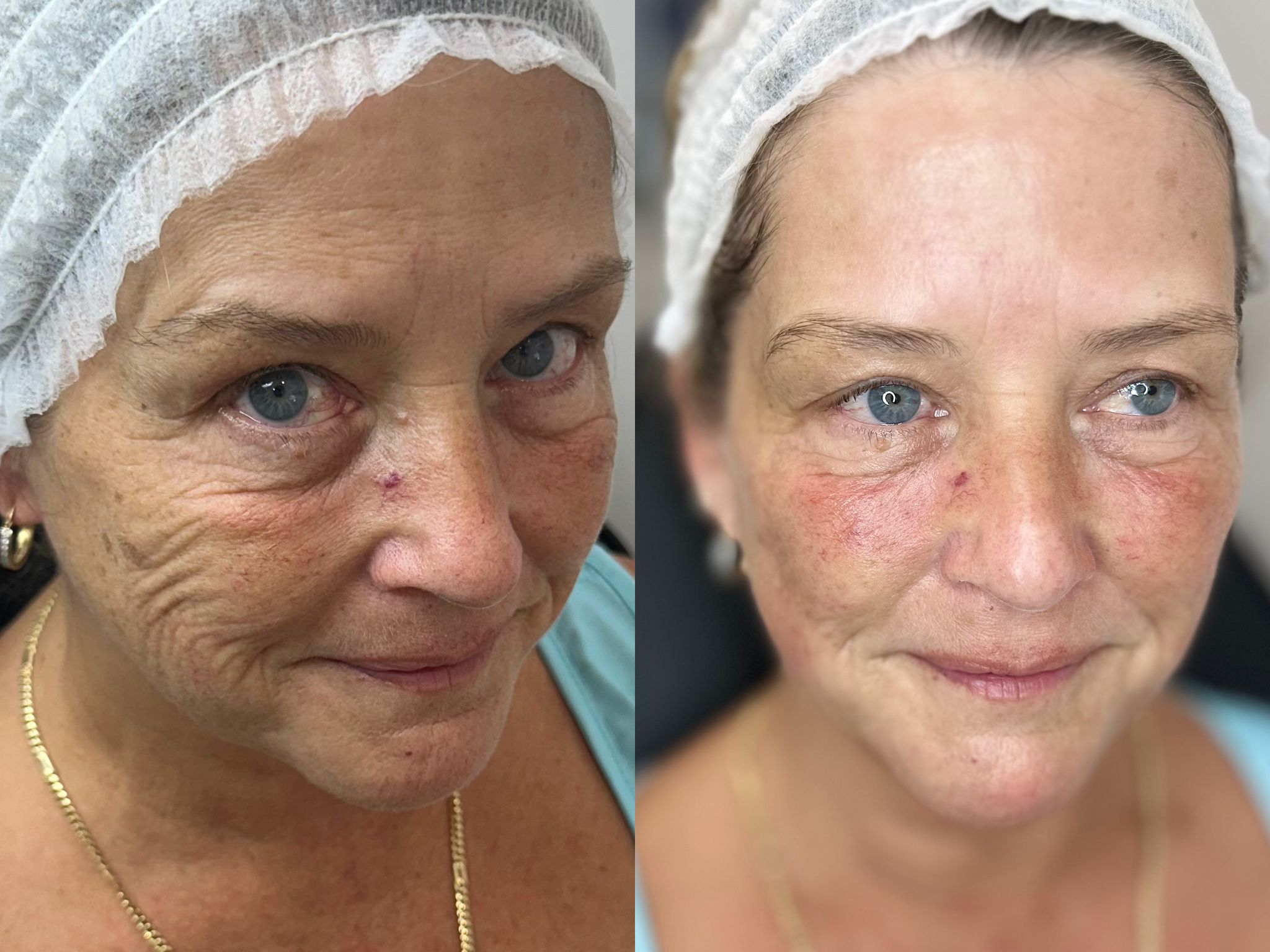 Before and after aesthetic treatment results