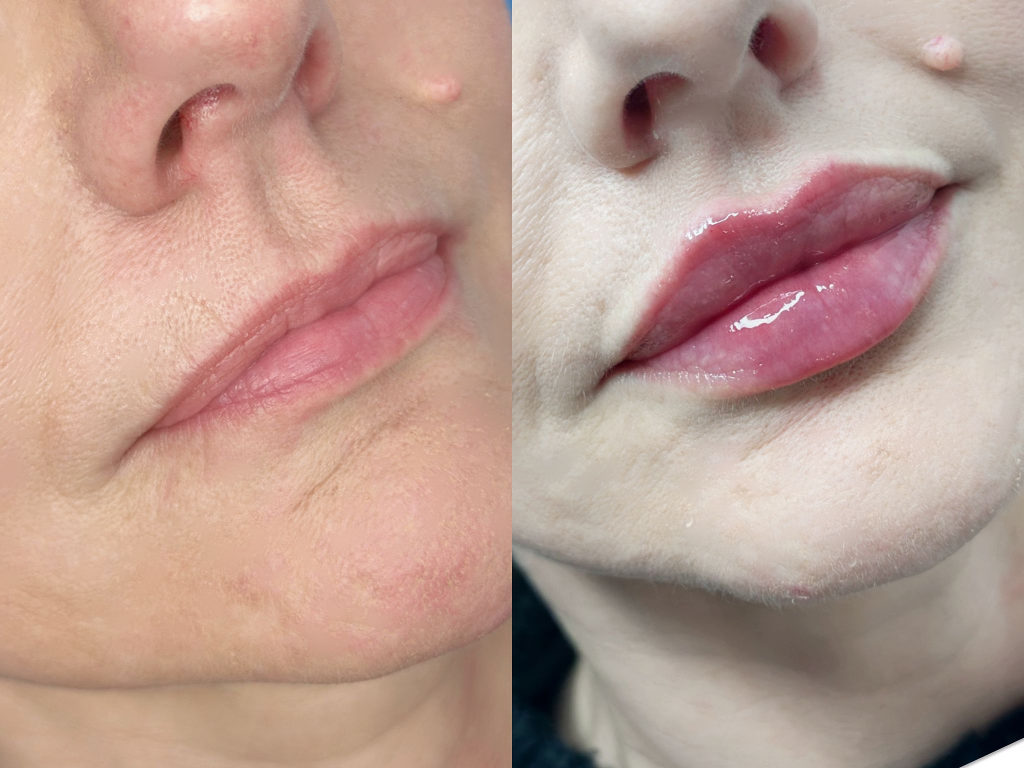 Before and after aesthetic treatment results