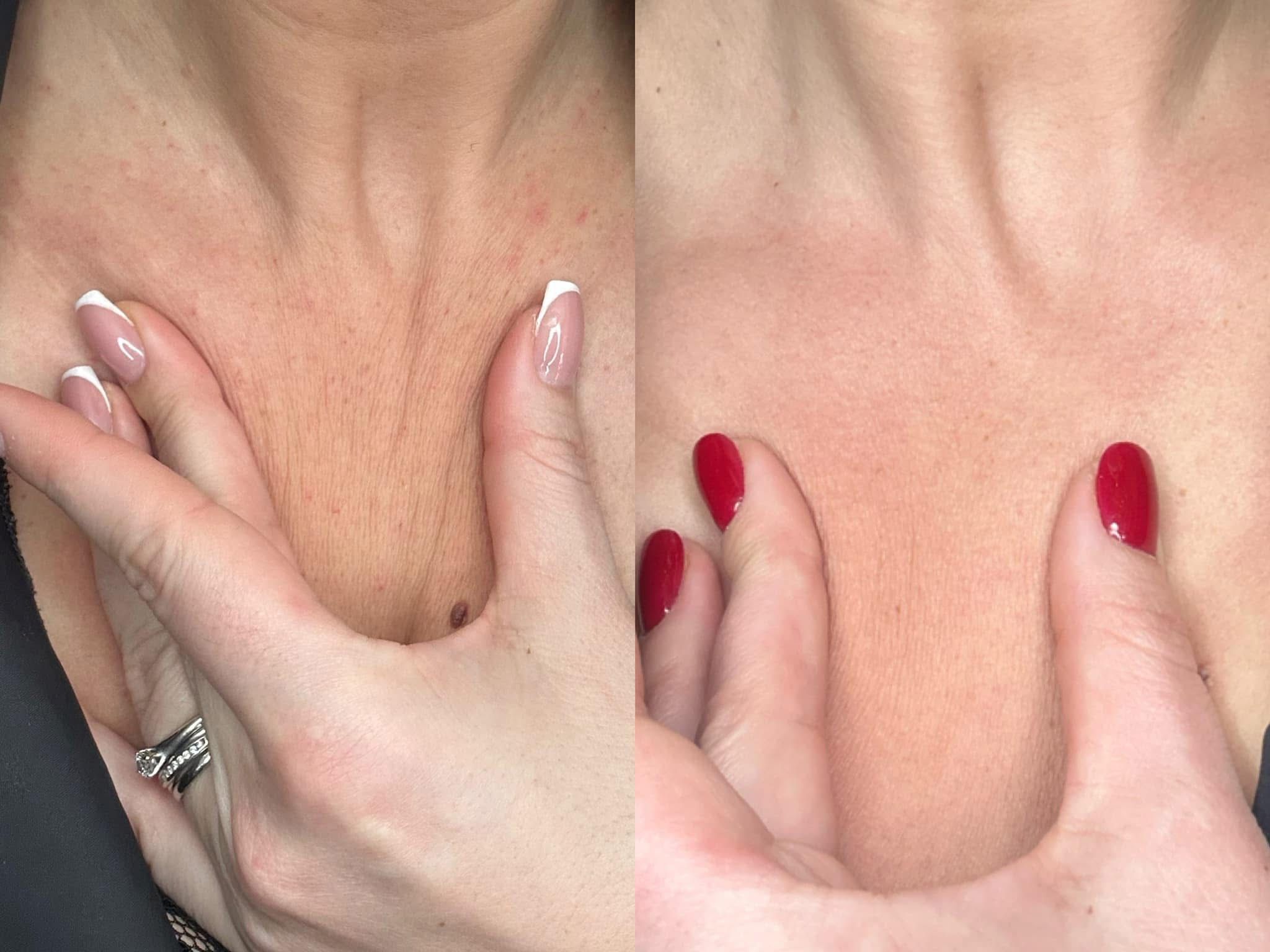 Before and after aesthetic treatment results