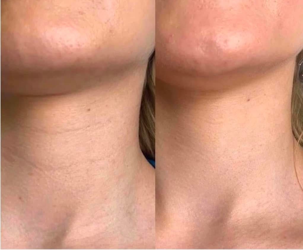 Before and after aesthetic treatment results